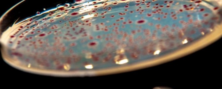 Identyfikacja drobnoustrojów Identyfikacja drobnoustrojów