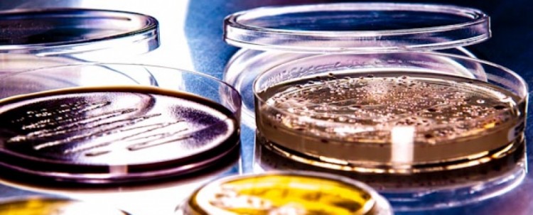 Badanie skuteczności sterylizacji Badanie skuteczności sterylizacji