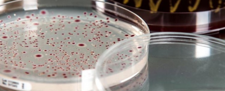 Testy konserwacji Testy konserwacji